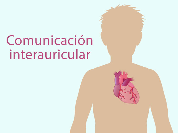 Una comunicación interauricular a veces se llama "orificio (agujero) en el corazón". Es una anomalía congénita.  Haz clic en estas diapositivas para obtener más información sobre este problema de salud.