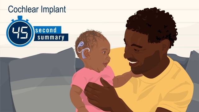 45-Second Summary: Cochlear Implant