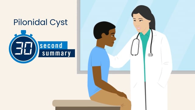 30-Second Summary: Pilonidal Cyst